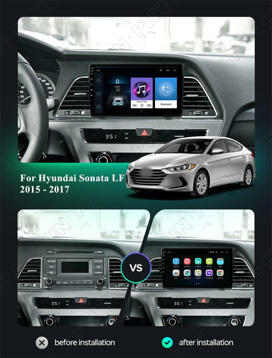 Android 10.1 9 Stereo Radio GPS WIFI Navi Head Unit for Hyundai Sonata 2015-17